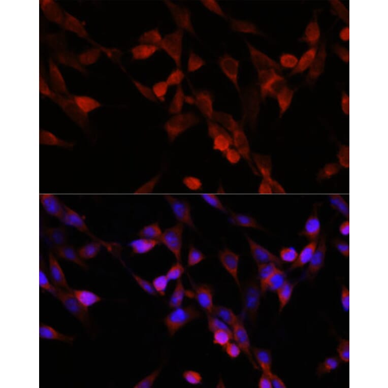 Immunofluorescence - Anti-UBIAD1 Antibody (A91563) - Antibodies.com
