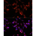 Immunofluorescence - Anti-UBIAD1 Antibody (A91563) - Antibodies.com