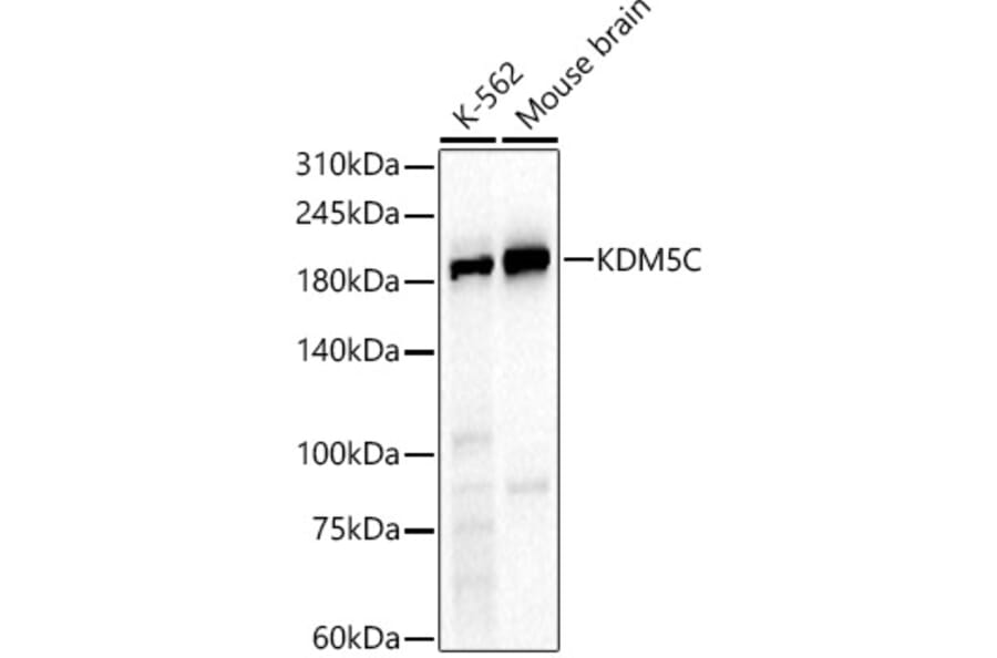 Western Blot - Anti-KDM5C/Jarid1C/SMCX Antibody (A91567) - Antibodies.com