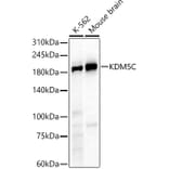 Western Blot - Anti-KDM5C/Jarid1C/SMCX Antibody (A91567) - Antibodies.com