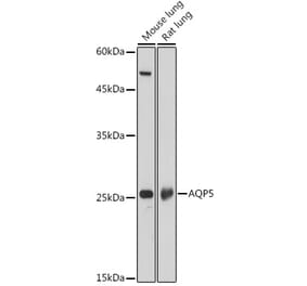 Western Blot - Anti-Aquaporin 5 Antibody (A91568) - Antibodies.com