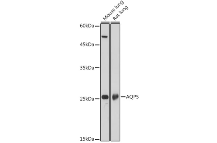Western Blot - Anti-Aquaporin 5 Antibody (A91568) - Antibodies.com