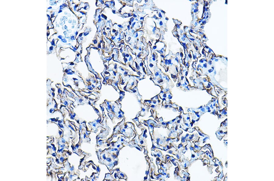 Immunohistochemistry - Anti-Aquaporin 5 Antibody (A91568) - Antibodies.com