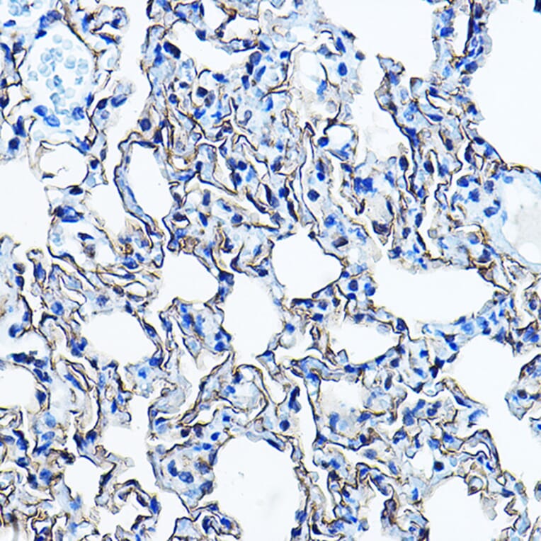 Immunohistochemistry - Anti-Aquaporin 5 Antibody (A91568) - Antibodies.com