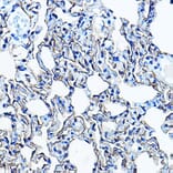 Immunohistochemistry - Anti-Aquaporin 5 Antibody (A91568) - Antibodies.com