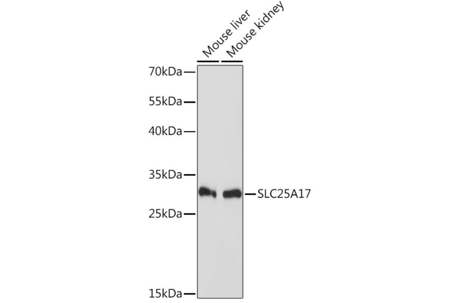 Western Blot - Anti-SLC25A17 Antibody (A91572) - Antibodies.com