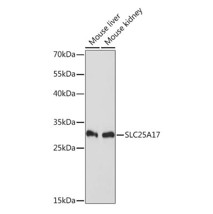 Western Blot - Anti-SLC25A17 Antibody (A91572) - Antibodies.com