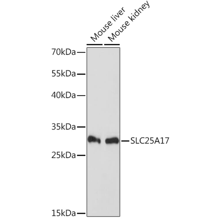 Western Blot - Anti-SLC25A17 Antibody (A91572) - Antibodies.com