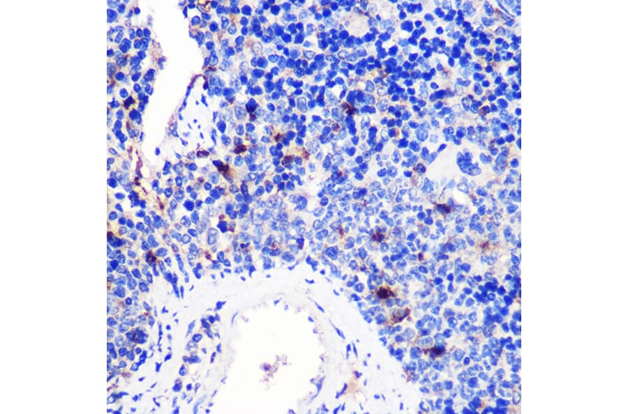 Immunohistochemistry - Anti-CD137 Antibody (A91573) - Antibodies.com
