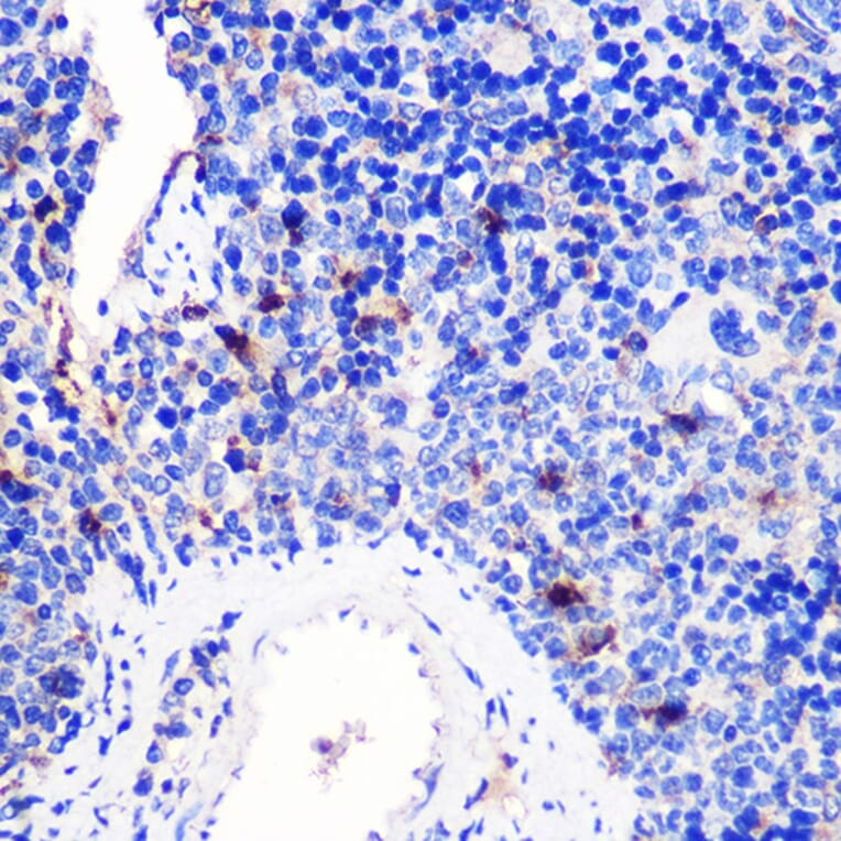 Immunohistochemistry - Anti-CD137 Antibody (A91573) - Antibodies.com