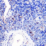 Immunohistochemistry - Anti-CD137 Antibody (A91573) - Antibodies.com