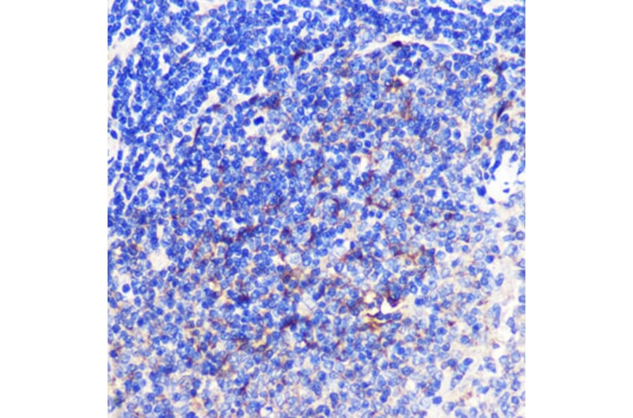 Immunohistochemistry - Anti-CD137 Antibody (A91573) - Antibodies.com