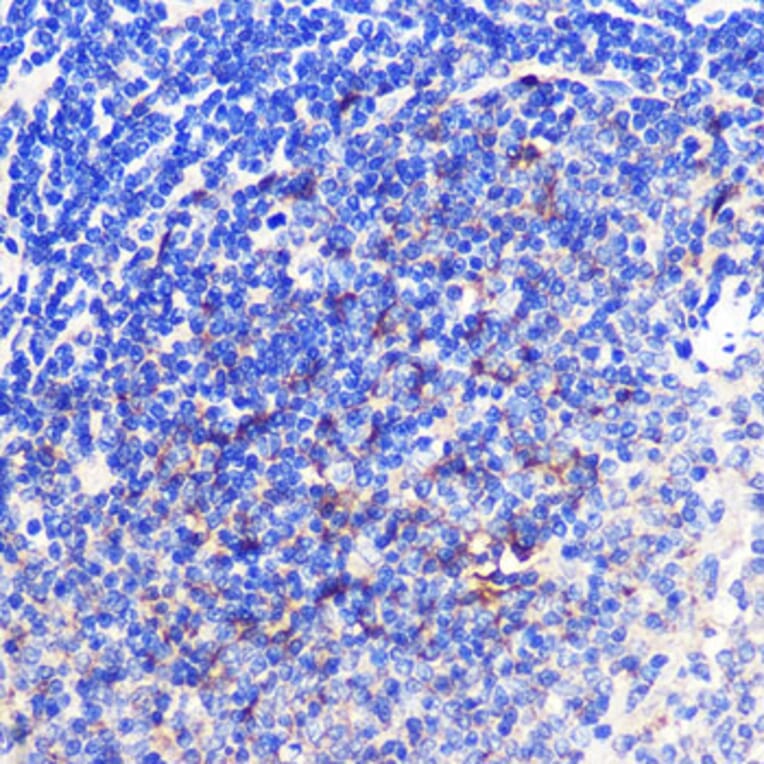 Immunohistochemistry - Anti-CD137 Antibody (A91573) - Antibodies.com