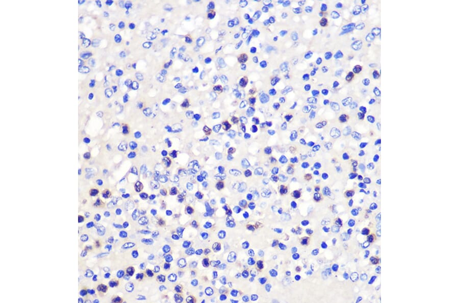 Immunohistochemistry - Anti-CD137 Antibody (A91573) - Antibodies.com