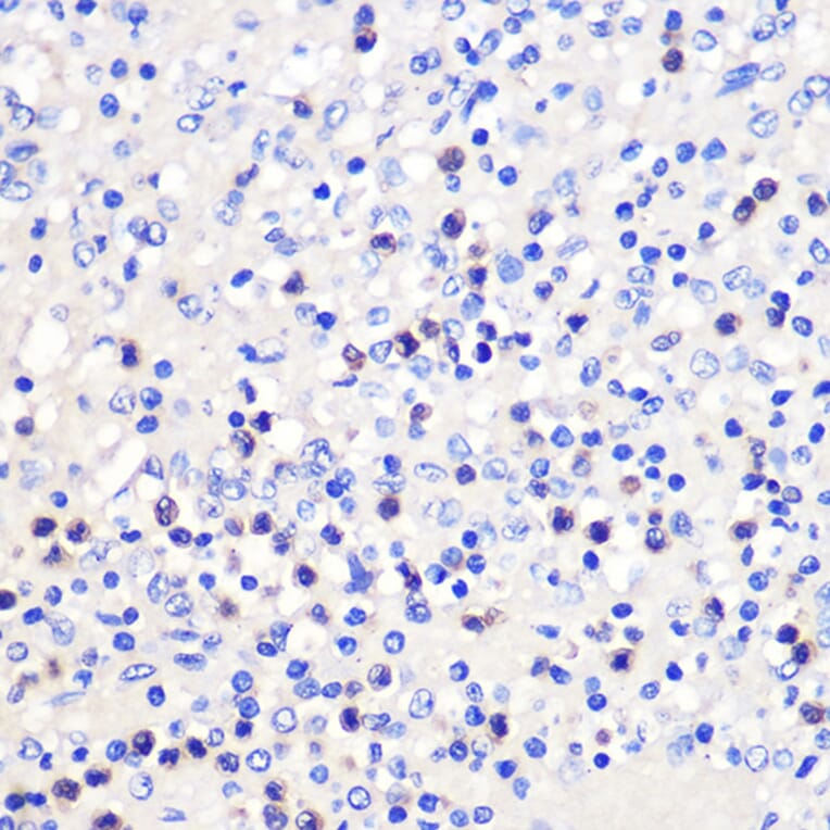 Immunohistochemistry - Anti-CD137 Antibody (A91573) - Antibodies.com