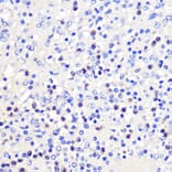 Immunohistochemistry - Anti-CD137 Antibody (A91573) - Antibodies.com