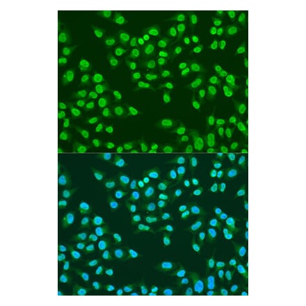 Immunofluorescence - Anti-ATM Antibody (A91574) - Antibodies.com