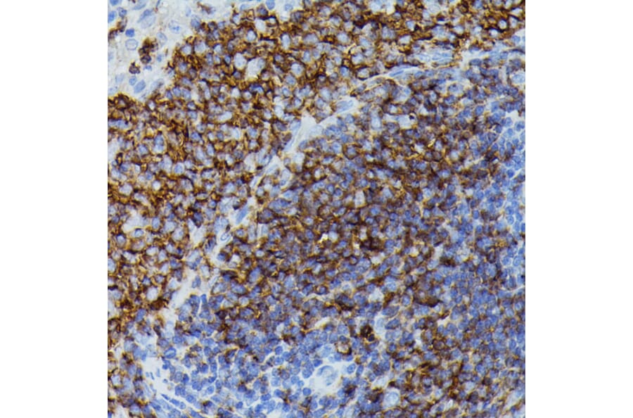 Immunohistochemistry - Anti-Apolipoprotein CIII Antibody (A91575) - Antibodies.com