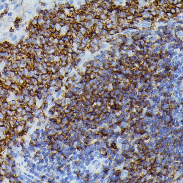 Immunohistochemistry - Anti-Apolipoprotein CIII Antibody (A91575) - Antibodies.com