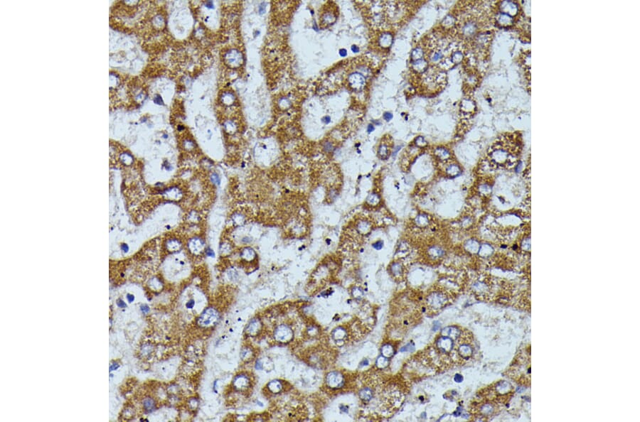 Immunohistochemistry - Anti-Apolipoprotein CIII Antibody (A91575) - Antibodies.com