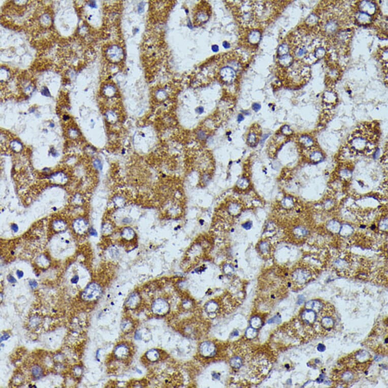 Immunohistochemistry - Anti-Apolipoprotein CIII Antibody (A91575) - Antibodies.com