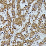 Immunohistochemistry - Anti-Apolipoprotein CIII Antibody (A91575) - Antibodies.com