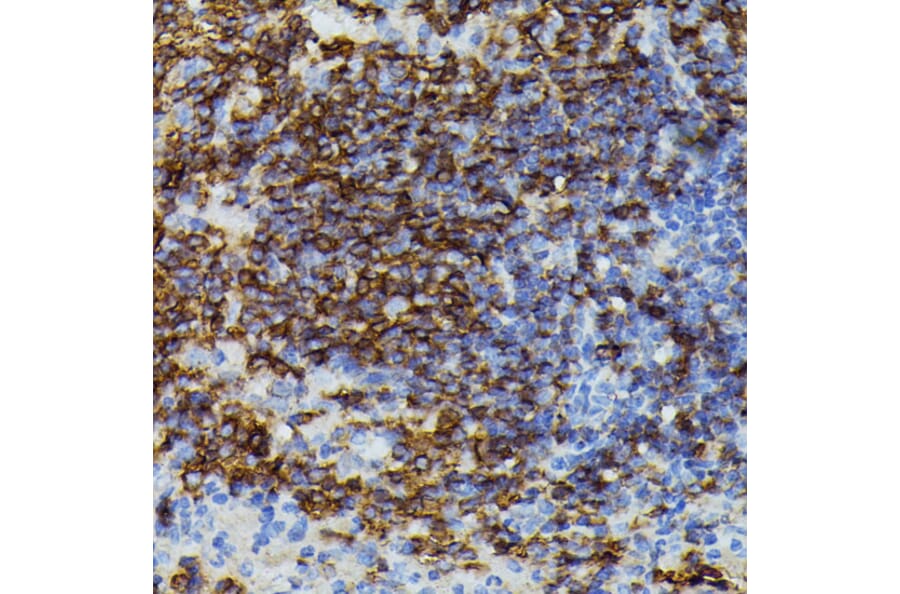 Immunohistochemistry - Anti-Apolipoprotein CIII Antibody (A91575) - Antibodies.com