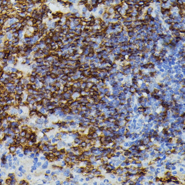 Immunohistochemistry - Anti-Apolipoprotein CIII Antibody (A91575) - Antibodies.com