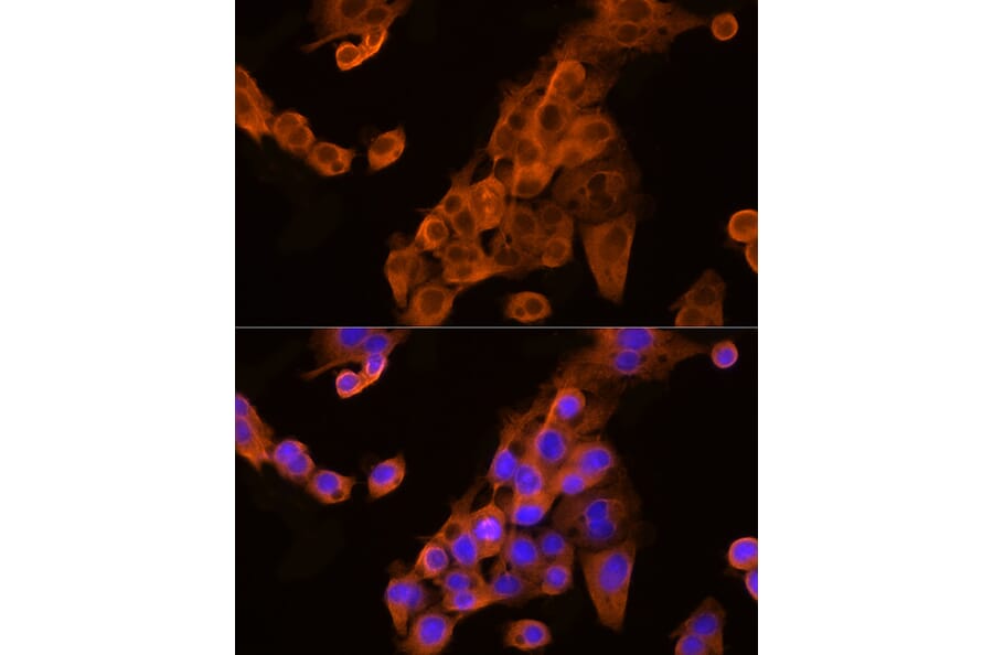 Immunofluorescence - Anti-Apolipoprotein CIII Antibody (A91575) - Antibodies.com