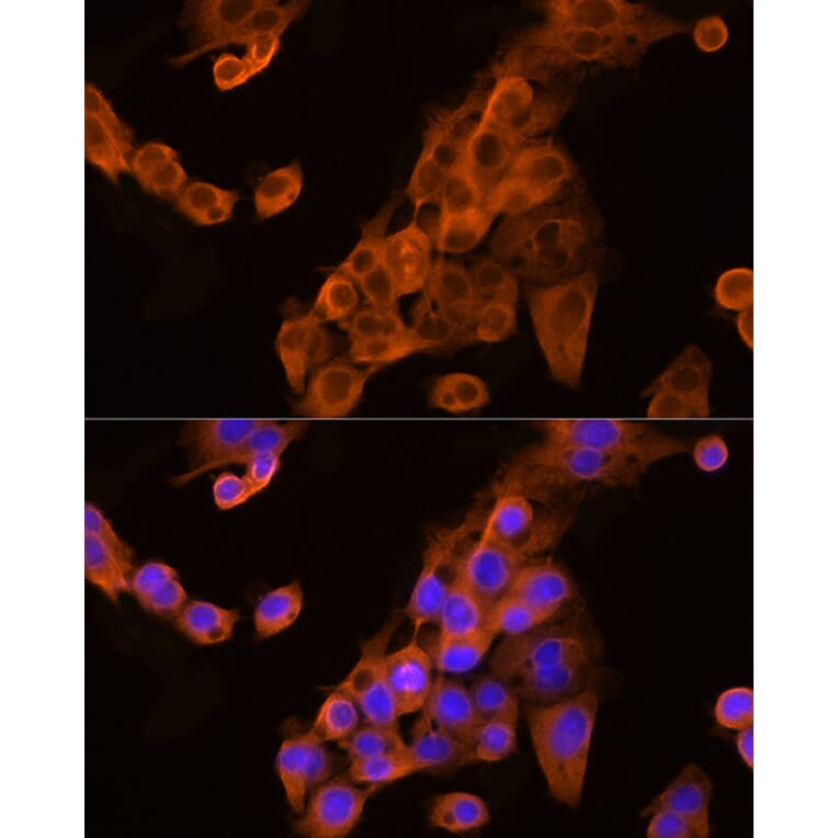 Immunofluorescence - Anti-Apolipoprotein CIII Antibody (A91575) - Antibodies.com