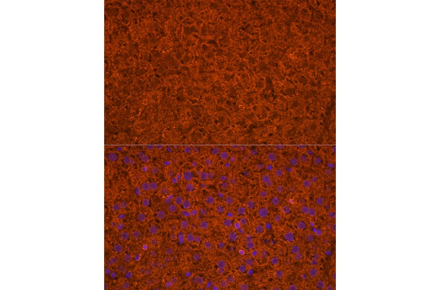 Immunofluorescence - Anti-Apolipoprotein CIII Antibody (A91575) - Antibodies.com
