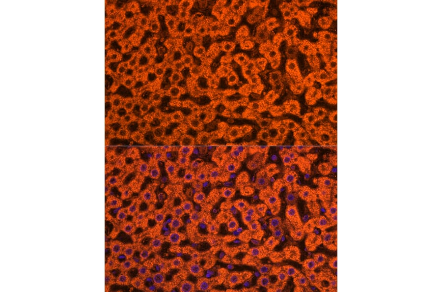 Immunofluorescence - Anti-Apolipoprotein CIII Antibody (A91575) - Antibodies.com