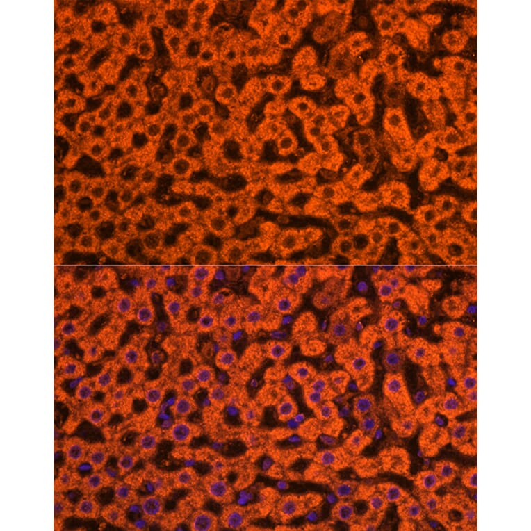 Immunofluorescence - Anti-Apolipoprotein CIII Antibody (A91575) - Antibodies.com