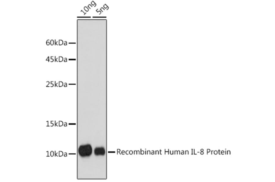Western Blot - Anti-IL-8 Antibody (A91576) - Antibodies.com
