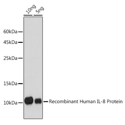 Western Blot - Anti-IL-8 Antibody (A91576) - Antibodies.com