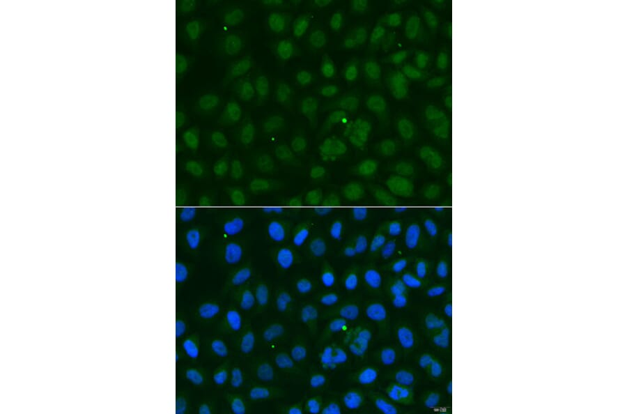 Immunofluorescence - Anti-SUMO1 Antibody (A12529) - Antibodies.com
