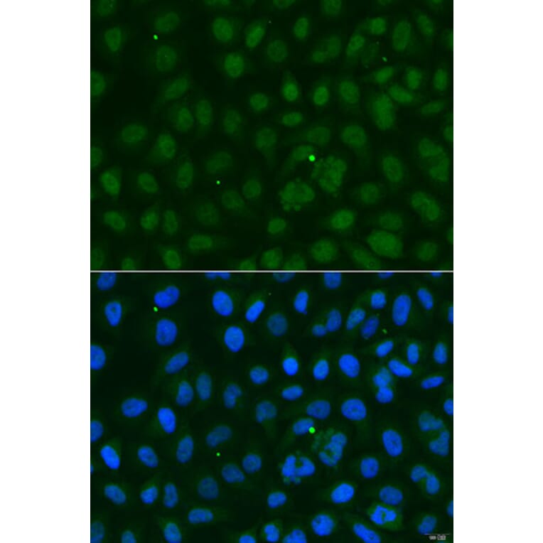 Immunofluorescence - Anti-SUMO1 Antibody (A12529) - Antibodies.com