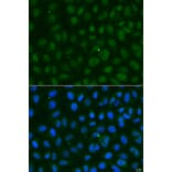 Immunofluorescence - Anti-SUMO1 Antibody (A12529) - Antibodies.com