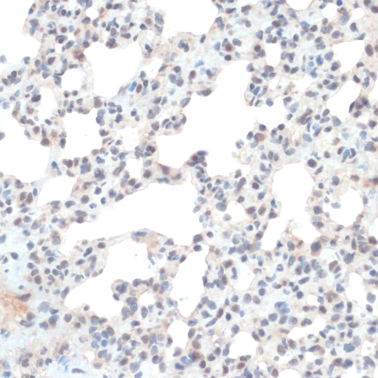 Immunohistochemistry - Anti-Thioredoxin / TRX Antibody (A91578) - Antibodies.com