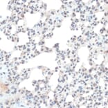 Immunohistochemistry - Anti-Thioredoxin / TRX Antibody (A91578) - Antibodies.com