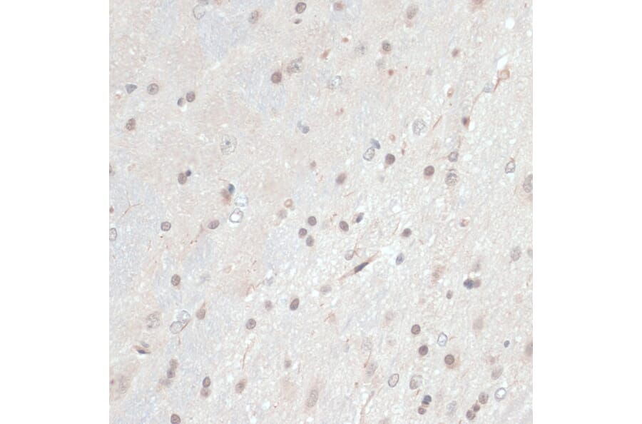 Immunohistochemistry - Anti-Thioredoxin / TRX Antibody (A91578) - Antibodies.com