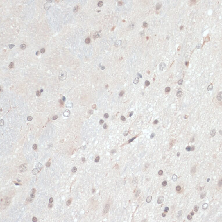 Immunohistochemistry - Anti-Thioredoxin / TRX Antibody (A91578) - Antibodies.com