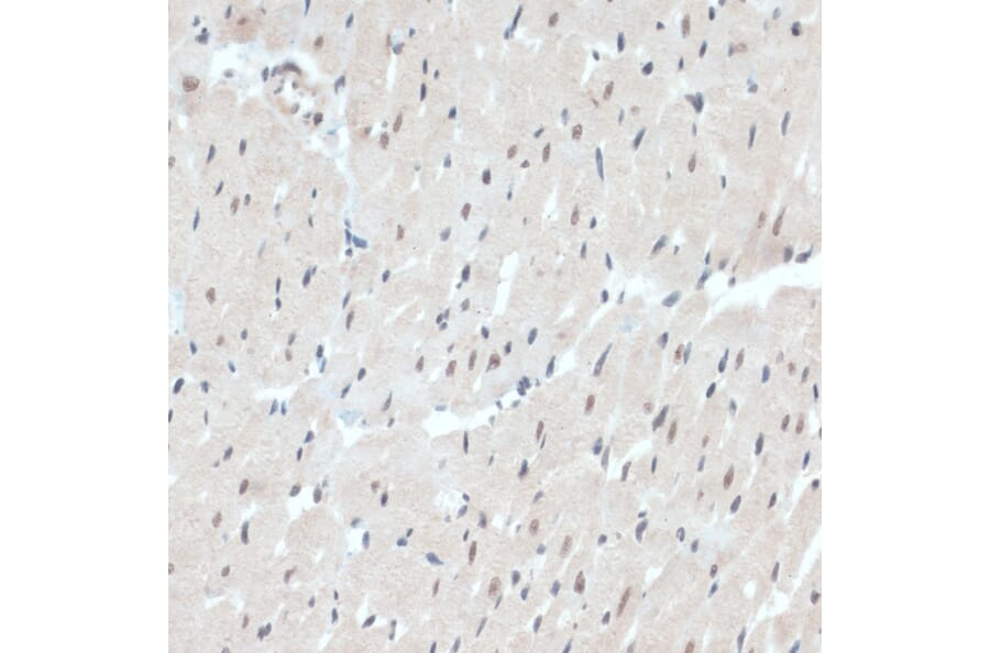 Immunohistochemistry - Anti-Thioredoxin / TRX Antibody (A91578) - Antibodies.com