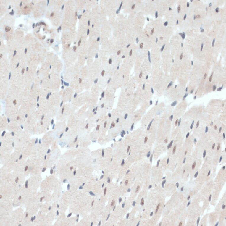 Immunohistochemistry - Anti-Thioredoxin / TRX Antibody (A91578) - Antibodies.com