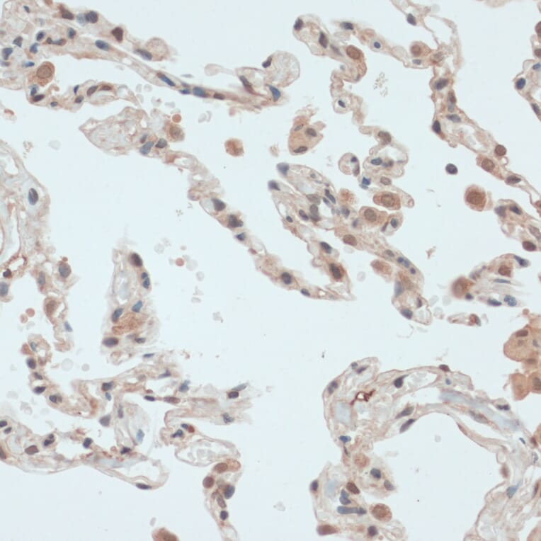 Immunohistochemistry - Anti-Thioredoxin / TRX Antibody (A91578) - Antibodies.com