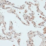 Immunohistochemistry - Anti-Thioredoxin / TRX Antibody (A91578) - Antibodies.com