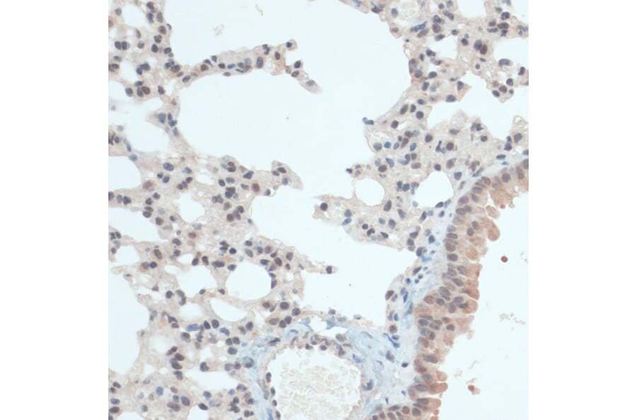 Immunohistochemistry - Anti-Thioredoxin / TRX Antibody (A91578) - Antibodies.com