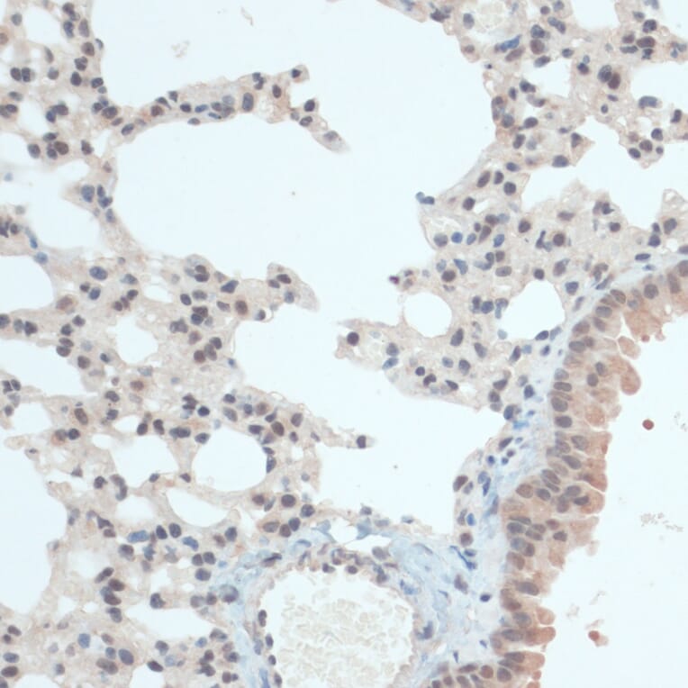 Immunohistochemistry - Anti-Thioredoxin / TRX Antibody (A91578) - Antibodies.com
