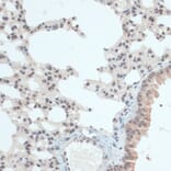 Immunohistochemistry - Anti-Thioredoxin / TRX Antibody (A91578) - Antibodies.com