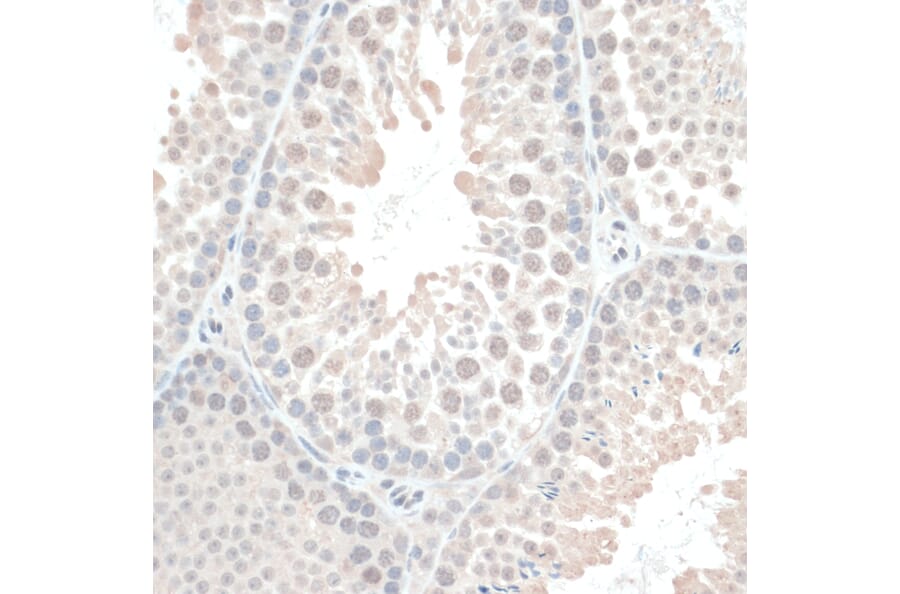 Immunohistochemistry - Anti-Thioredoxin / TRX Antibody (A91578) - Antibodies.com